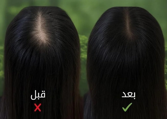 قبل وبعد